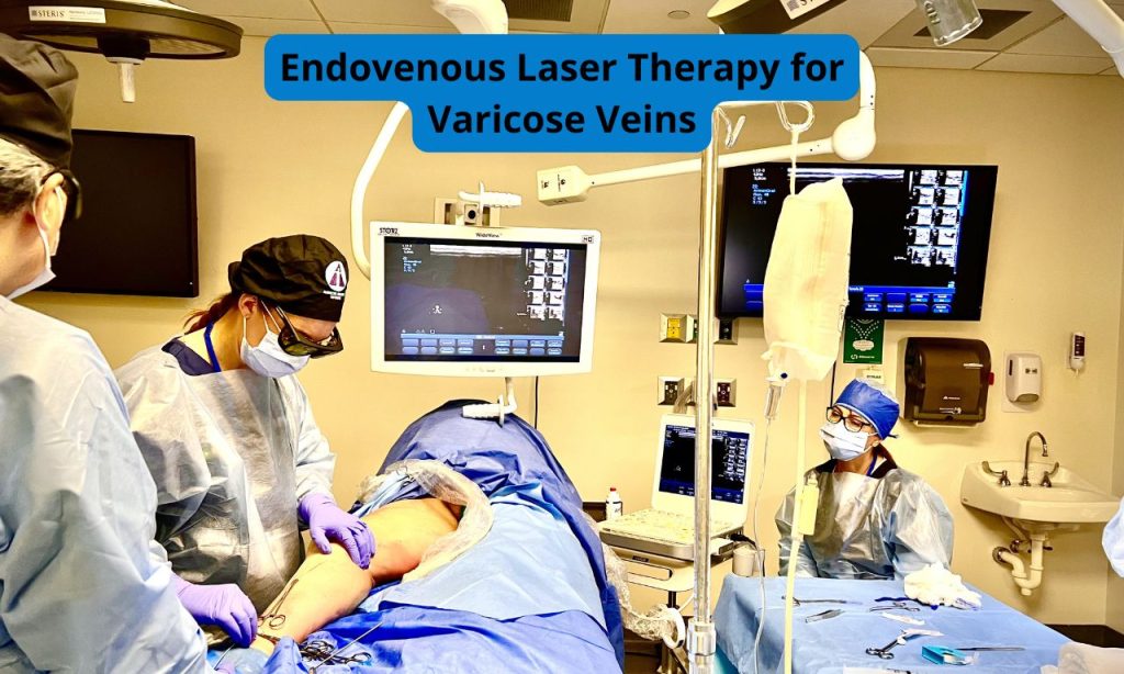 Endovenous Laser Therapy (EVLT) for Varicose Veins