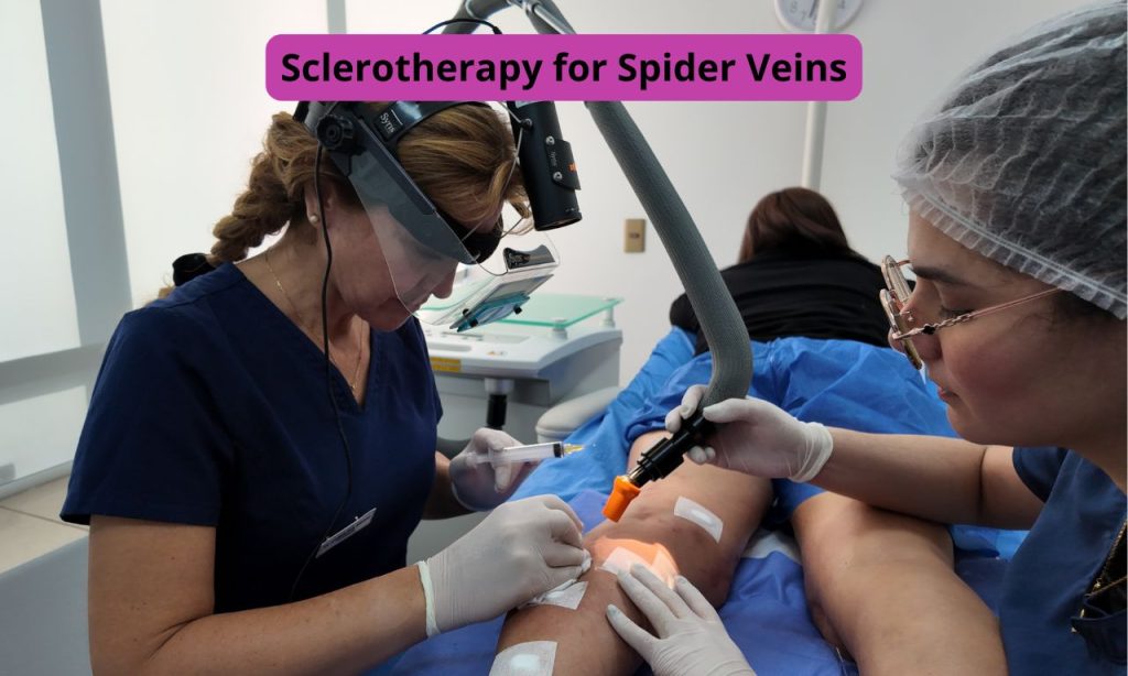 Sclerotherapy for Spider Veins: Treatment and Results